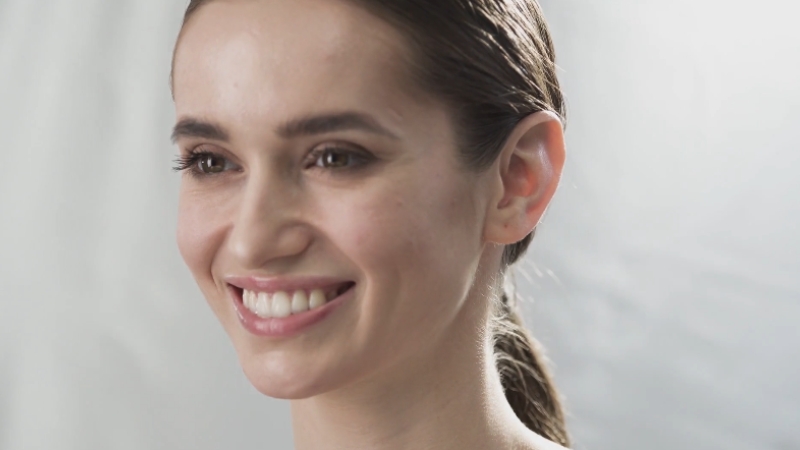 A woman with glowing, smooth skin, showcasing the results after 2–6 months of microneedling treatment